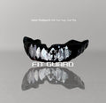 Teeth mouthguard